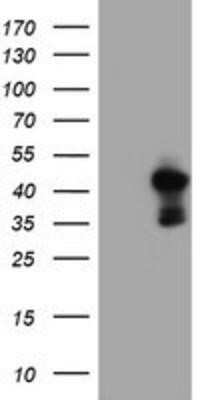 Western Blot: PDSS2 Antibody (OTI1D12) - Azide and BSA Free [NBP2-73323] - HEK293T cells were transfected with the pCMV6-ENTRY control (Left lane) or pCMV6-ENTRY PDSS2 (Right lane) cDNA for 48 hrs and lysed. Equivalent amounts of cell lysates (5 ug per lane) were separated by SDS-PAGE and immunoblotted with anti-PDSS2.