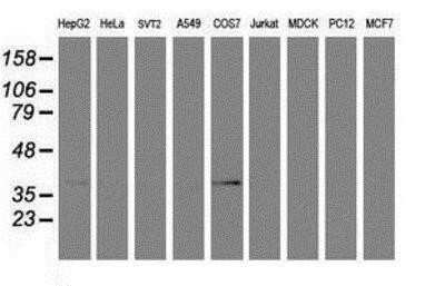 Western Blot: PDSS2 Antibody (OTI1D12) - Azide and BSA Free [NBP2-73323] - Analysis of extracts (35ug) from 9 different cell lines by using anti-PDSS2 monoclonal antibody.