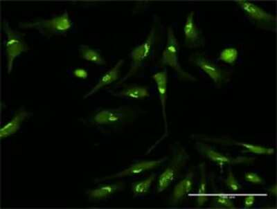 Immunocytochemistry/Immunofluorescence: PDXDC1 Antibody [H00023042-D01P] - Analysis of antibody to PDXDC1 on HeLa cell. Antibody concentration 10 ug/ml.
