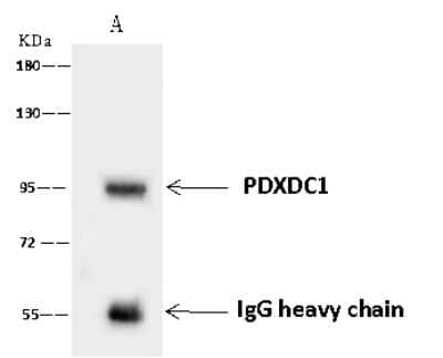 Immunoprecipitation: PDXDC1 Antibody [NBP2-97693] - PDXDC1 was immunoprecipitated using: Lane A: 0.5 mg U-251MG Whole Cell Lysate 4 ul anti-PDXDC1 rabbit polyclonal antibody and 60 ug of Immunomagnetic beads Protein A/G.  Primary antibody: Anti-PDXDC1 rabbit polyclonal antibody, at 1:100 dilution. Secondary antibody: Goat Anti-Rabbit IgG (H+L)/HRP at 1/10000 dilution. Developed using the ECL technique. Performed under reducing conditions. Predicted band size: 87 kDa. Observed band size: 95 kDa