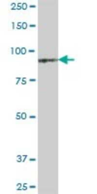 Western Blot: PDXDC1 Antibody [H00023042-B01P] - Analysis of KIAA0251 expression in human placenta.