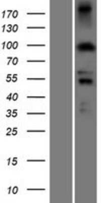 Western Blot PDXDC1 Overexpression Lysate