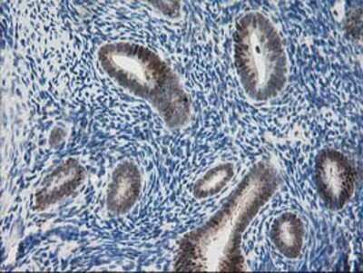 Immunohistochemistry-Paraffin: PDXK Antibody (5H5) [NBP2-00821] - Staining of paraffin-embedded Human endometrium tissue using anti-PDXK mouse monoclonal antibody.