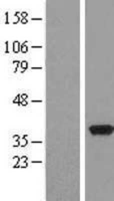 Western Blot: PDXK Overexpression Lysate (Adult Normal) [NBL1-14267] Left-Empty vector transfected control cell lysate (HEK293 cell lysate); Right -Over-expression Lysate for PDXK.