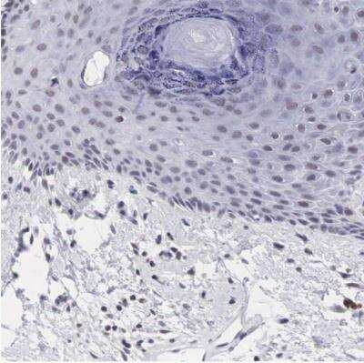 Immunohistochemistry-Paraffin: PDXP Antibody [NBP2-48487] - Staining of human skin shows no positivity in squamous epithelial cells as expected.