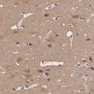 Immunohistochemistry-Paraffin: PDXP Antibody [NBP2-48487] - Staining of human cerebral cortex shows moderate to strong positivity positivity in neurons and neuropil.