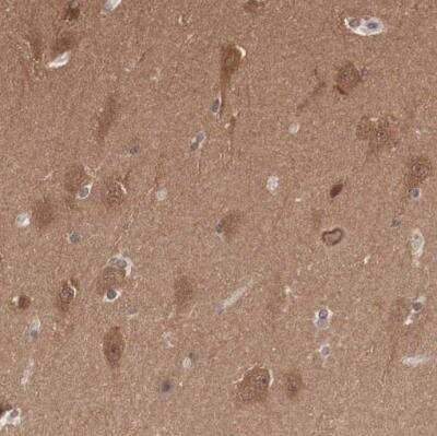 Immunohistochemistry-Paraffin: PDXP Antibody [NBP2-48487] - Staining of human hippocampus shows moderate to strong cytoplasmic positivity in neurons.