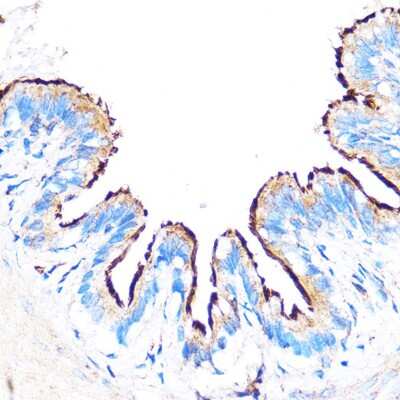 Immunohistochemistry-Paraffin: PDXP Antibody [NBP2-93574] - Immunohistochemistry of paraffin-embedded Rat lung using PDXP Rabbit pAb (NBP2-93574) at dilution of 1:100 (40x lens). Perform microwave antigen retrieval with 10 mM PBS buffer pH 7.2 before commencing with IHC staining protocol.