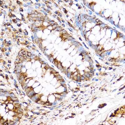 Immunohistochemistry-Paraffin: PDXP Antibody [NBP2-93574] - Immunohistochemistry of paraffin-embedded Human colon using PDXP Rabbit pAb (NBP2-93574) at dilution of 1:100 (40x lens). Perform microwave antigen retrieval with 10 mM PBS buffer pH 7.2 before commencing with IHC staining protocol.