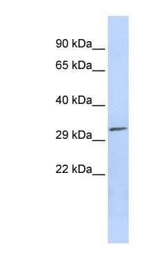 Western Blot: PDXP Antibody [NBP1-56888] - Titration: 0.2-1 ug/ml, Positive Control: Jurkat cell lysate.