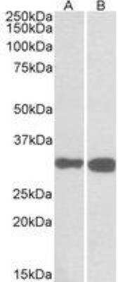 Western Blot: PDXP Antibody [NBP2-27461] - 0.1 ug/ml staining of Mouse (A) and Rat (B) Brain lysates (35 ug protein in RIPA buffer). Primary incubation was 1 hour. Detected by chemiluminescence.