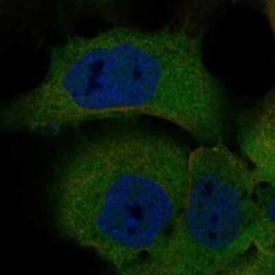 Immunocytochemistry/Immunofluorescence: PDZD2/PDZK3 Antibody [NBP3-17289] - Staining of human cell line EFO-21 shows localization to plasma membrane & cytosol.