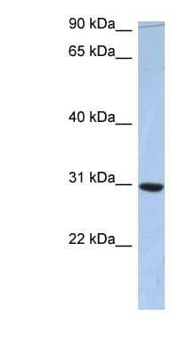 Western Blot: PDZD9 Antibody [NBP1-56800] - Human Small Intestine, concentration 0.2-1 ug/ml.