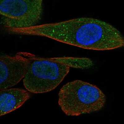 Immunocytochemistry/Immunofluorescence: PDZK1 Antibody [NBP1-82572] - Staining of human cell line RPTEC TERT1 shows localization to nucleus, cytosol & vesicles. Antibody staining is shown in green.