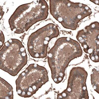 Immunohistochemistry-Paraffin: PDZK1 Antibody [NBP1-82572] - Staining of human small intestine shows moderate to strong positivity in luminal membrane in glandular cells.