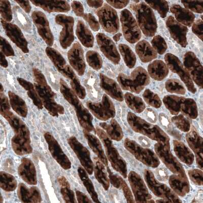 Immunohistochemistry-Paraffin: PDZK1 Antibody [NBP1-82572] - Staining of human kidney shows moderate to strong positivity in apical membrane in cells in proximal tubules.