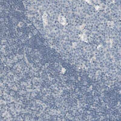 Immunohistochemistry-Paraffin: PDZK1 Antibody [NBP1-82573] - Staining of human lymph node shows low expression as expected.