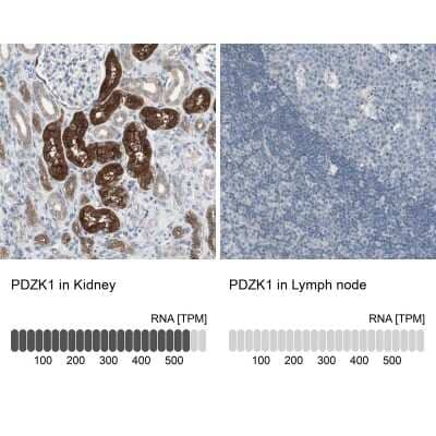 <b>Orthogonal Strategies Validation. </b>Immunohistochemistry-Paraffin: PDZK1 Antibody [NBP1-82573] - Staining in human kidney and lymph node tissues using anti-PDZK1 antibody. Corresponding PDZK1 RNA-seq data are presented for the same tissues.