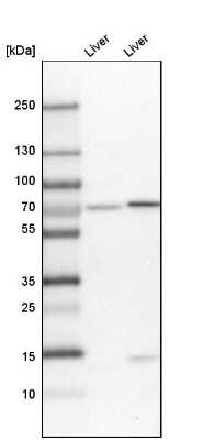 Western Blot: PDZK1 Antibody [NBP1-82572] - Western blot analysis in mouse liver tissue and rat liver tissue.