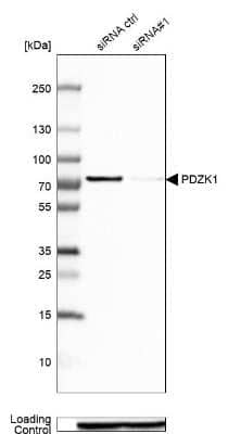 <b>Genetic Strategies Validation and Orthogonal Strategies Validation.</b>Western Blot: PDZK1 Antibody [NBP1-82572] - Analysis in Caco-2 cells transfected with control siRNA, target specific siRNA probe #1, using anti-PDZK1 antibody. Remaining relative intensity is presented. Loading control: anti-GAPDH.