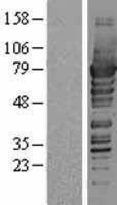 Western Blot: PDZK1 Overexpression Lysate (Adult Normal) [NBP2-04231] Left-Empty vector transfected control cell lysate (HEK293 cell lysate); Right -Over-expression Lysate for PDZK1.