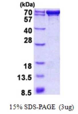 SDS-PAGE Recombinant Human PDZK1 His Protein