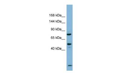 Western Blot: PDZRN3 Antibody [NBP2-88028] - Host: Rabbit. Target Name: PDZRN3. Sample Type: Fetal Thymus lysates. Antibody Dilution: 1.0ug/ml