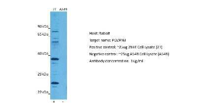 Western Blot: PDZRN3 Antibody [NBP2-88028] - Host: Rabbit. Target: PDZRN3. Positive control (+): 293T (2T). Negative control (-): A549 (N03). Antibody concentration: 1ug/ml