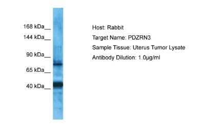 Western Blot: PDZRN3 Antibody [NBP2-88029] - Host: Rabbit. Target Name: PDZRN3. Sample Type: Uterus Tumor lysates. Antibody Dilution: 1.0ug/ml