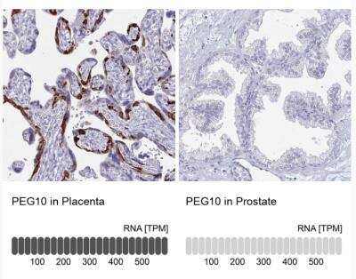 Immunohistochemistry-Paraffin: PEG10 Antibody [NBP2-13749] - Analysis in human placenta and prostate tissues using Anti-PEG10 antibody. Corresponding PEG10 RNA-seq data are presented for the same tissues.