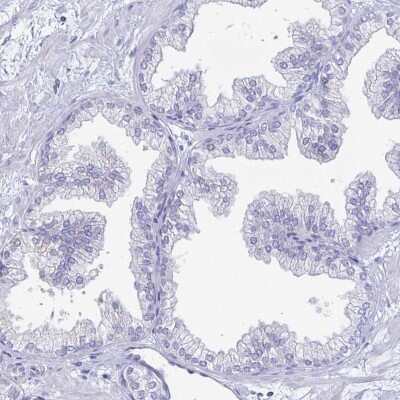 Immunohistochemistry-Paraffin: PEG10 Antibody [NBP2-13749] - Staining of human prostate shows low expression as expected.