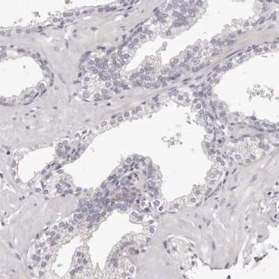 Immunohistochemistry-Paraffin: PEG10 Antibody [NBP2-48592] - Staining of human prostate shows low expression as expected.