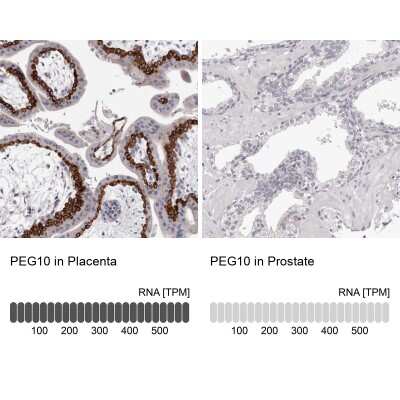 <b>Orthogonal Strategies Validation. </b>Immunohistochemistry-Paraffin: PEG10 Antibody [NBP2-48592] - Staining in human placenta and prostate tissues using anti-PEG10 antibody. Corresponding PEG10 RNA-seq data are presented for the same tissues.