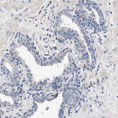 Immunohistochemistry-Paraffin: PEG10 Antibody [NBP2-54675] - Staining of human prostate shows low expression as expected.