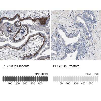 <b>Orthogonal Strategies Validation. </b>Immunohistochemistry-Paraffin: PEG10 Antibody [NBP2-54675] - Staining in human placenta and prostate tissues using anti-PEG10 antibody. Corresponding PEG10 RNA-seq data are presented for the same tissues.