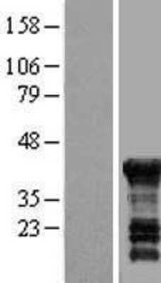 Western Blot: PEG10 Overexpression Lysate (Adult Normal) [NBL1-14280] Left-Empty vector transfected control cell lysate (HEK293 cell lysate); Right -Over-expression Lysate for PEG10.