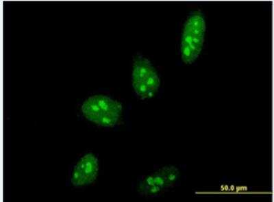 Immunocytochemistry/Immunofluorescence: PELP1 Antibody (4F3) [H00027043-M06-100ug] - PELP1 on HeLa cell . [antibody concentration 10 ug/ml]. 