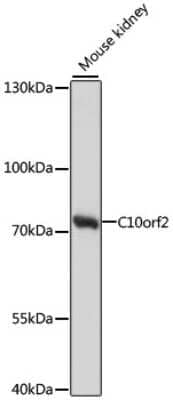 Western Blot: PEO1 Antibody [NBP2-94125] - Analysis of extracts of mouse kidney, using PEO1 at 1:1000 dilution.Secondary antibody: HRP Goat Anti-Rabbit IgG (H+L) at 1:10000 dilution.Lysates/proteins: 25ug per lane.Blocking buffer: 3% nonfat dry milk in TBST.Detection: ECL Basic Kit .Exposure time: 30s.