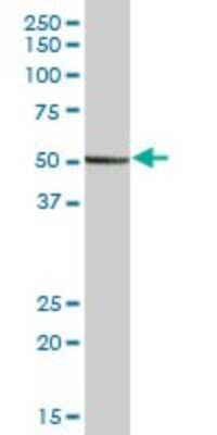 Western Blot: PEPD Antibody [H00005184-B01P] - Analysis of PEPD expression in human placenta.