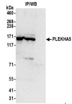 Immunoprecipitation PEPP2 Antibody - BSA Free