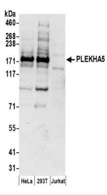 Western Blot PEPP2 Antibody - BSA Free