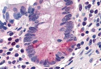 Immunohistochemistry-Paraffin: PEPT1/SLC15A1 Antibody [NBP1-39784] - Analysis of anti-SLC15A1 antibody with human small intestine, Paneth cells at concentration 20 ug/ml.