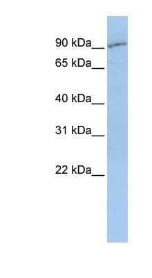 Western Blot: PEPT2/SLC15A2 Antibody [NBP1-59626] - MCF-7 whole cell lysates, concentration 0.2-1 ug/ml.