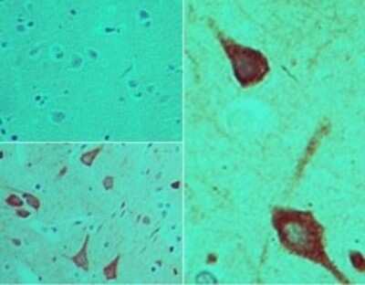 Immunohistochemistry-Paraffin: PER1 Antibody [NBP2-24692] - Analysis of PER1 in formalin-fixed, paraffin-embedded human brain tissue using an isotype control (top left) and NBP2-24692 (bottom left, right) at 5 ug/ml.