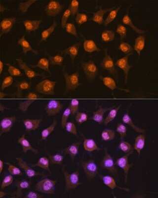 Immunocytochemistry/Immunofluorescence: PER2 Antibody (2K9Y0) [NBP3-16557] - Immunofluorescence analysis of HeLa cells using PER2 Rabbit mAb (NBP3-16557) at dilution of 1:100 (40x lens). Blue: DAPI for nuclear staining.