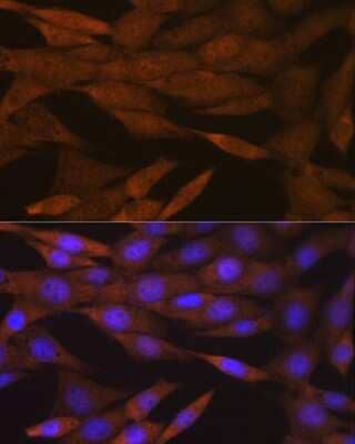 Immunocytochemistry/Immunofluorescence: PER2 Antibody (2K9Y0) [NBP3-16557] - Immunofluorescence analysis of NIH-3T3 cells using PER2 Rabbit mAb (NBP3-16557) at dilution of 1:100 (40x lens). Blue: DAPI for nuclear staining.