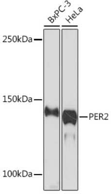 Western Blot: PER2 Antibody (2K9Y0) [NBP3-16557] - Western blot analysis of extracts of various cell lines, using PER2 Rabbit mAb (NBP3-16557) at 1:1000 dilution. Secondary antibody: HRP Goat Anti-Rabbit IgG (H+L) at 1:10000 dilution. Lysates/proteins: 25ug per lane. Blocking buffer: 3% nonfat dry milk in TBST. Detection: ECL Enhanced Kit. Exposure time: 3min.