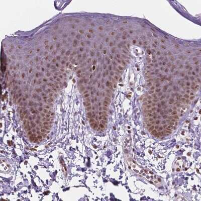 Immunohistochemistry-Paraffin: PER2 Antibody [NBP2-49316] - Staining of human skin shows moderate nuclear positivity in squamous epithelial cells.