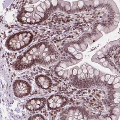 Immunohistochemistry-Paraffin: PER2 Antibody [NBP2-49316] - Staining of human small intestine shows strong nuclear positivity in glandular cells.