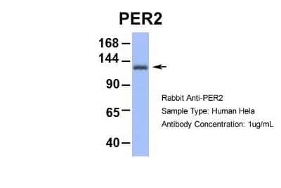 Western Blot: PER2 Antibody [NBP2-88036] - Host: Rabbit. Target Name: PER2. Sample Type: Human Hela. Antibody Dilution: 1.0ug/ml